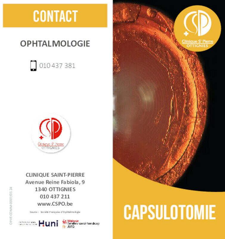 OPHT COMM 0007 Capsulotomie