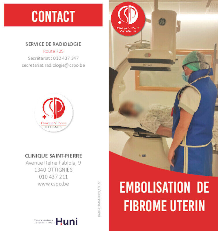 Embolisation fibrome utérin